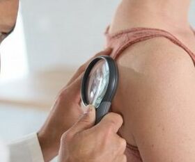 How to determine human papillomavirus