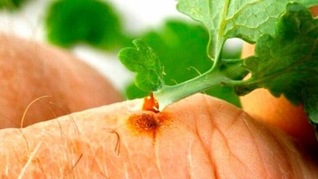Apply celandine juice to a wart