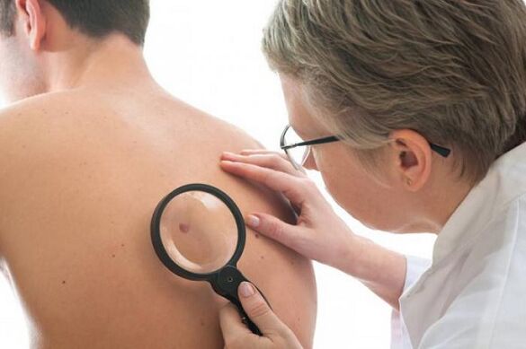 The doctor examines the papilloma on the back.